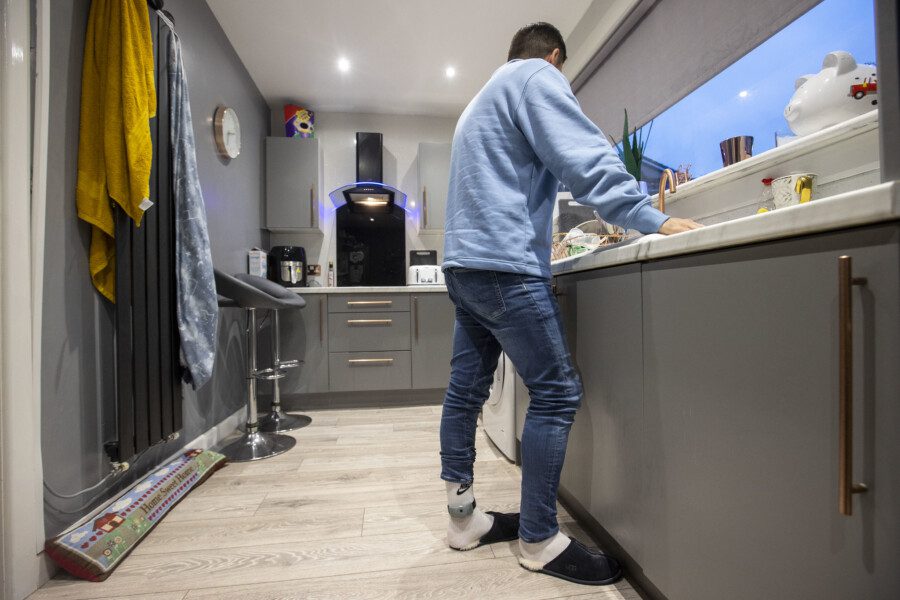 A man standing in a modern kitchen, there is an electronic tag attached to his ankle.